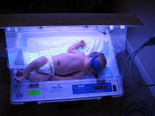 светотерапия новорожденных